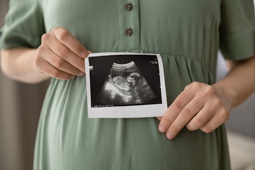 ultrasound-image